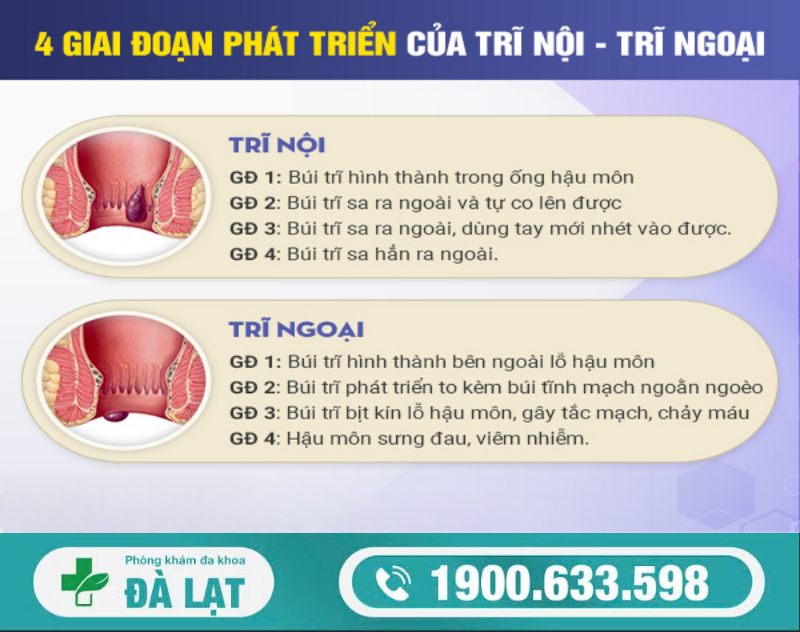 Hình ảnh minh họa